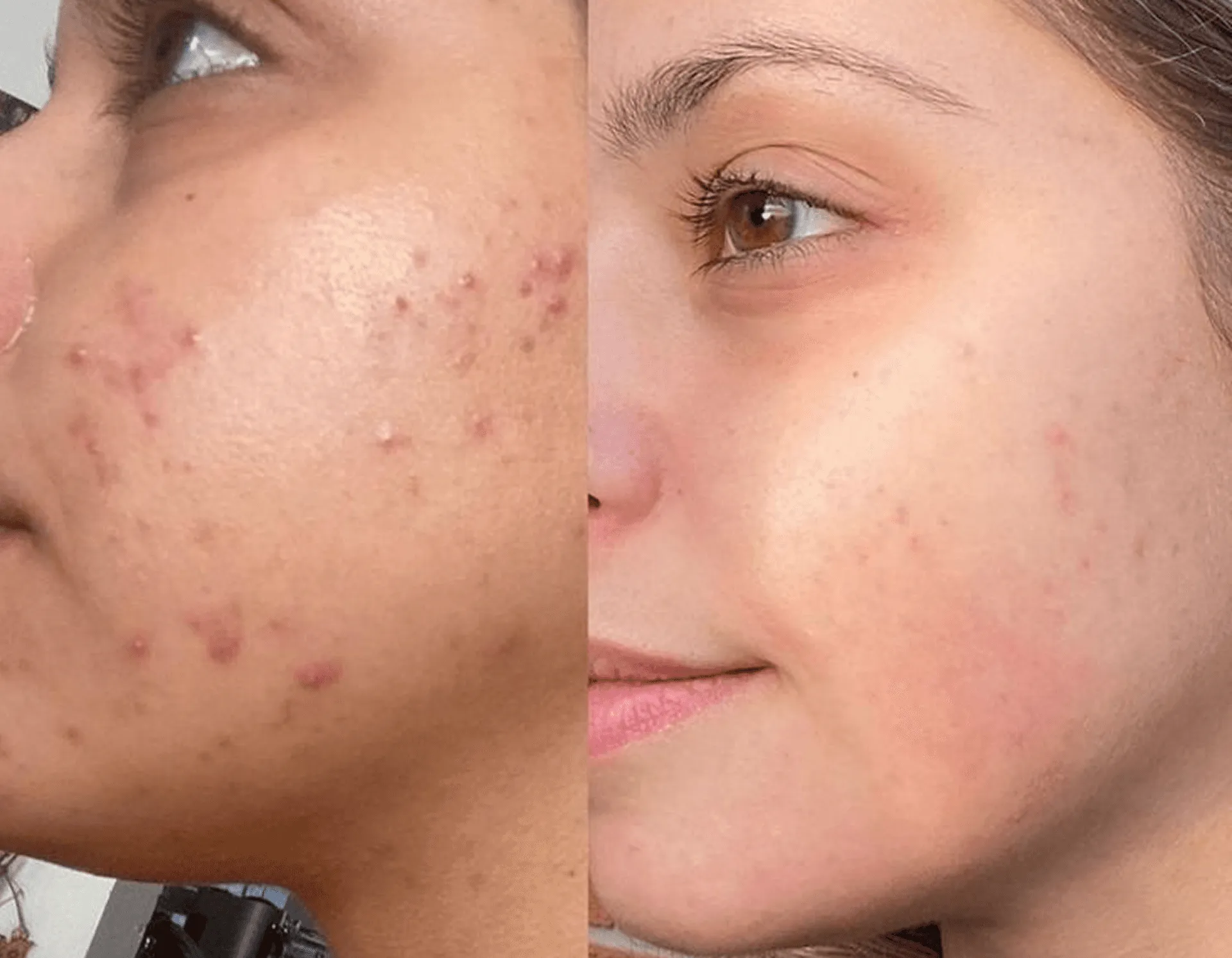 Before and After Treatment Results