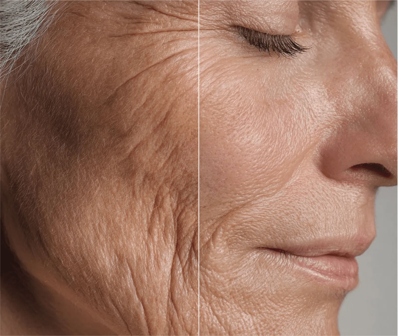 Anti-Aging Treatments