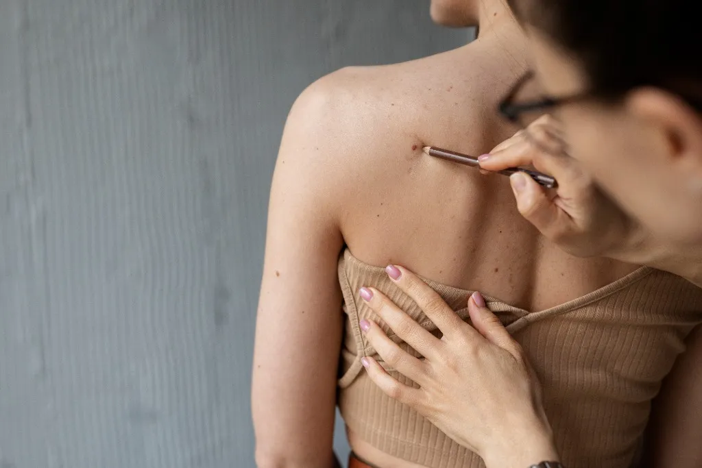 Skin Tag & Wart Removal