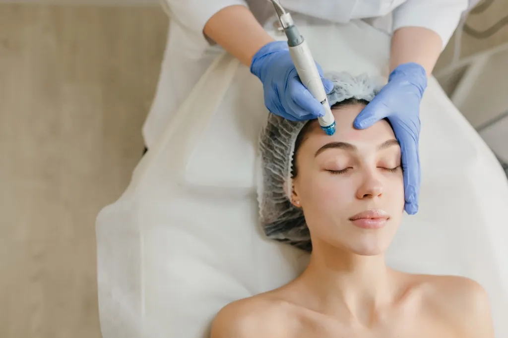 Microneedling