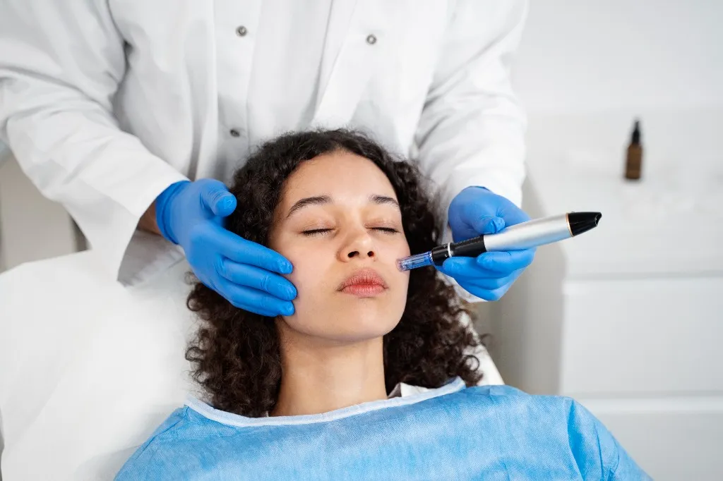MNRF (Microneedle Radiofrequency)